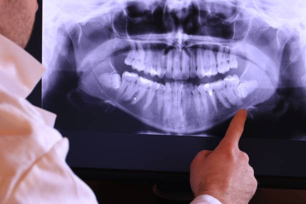 Best Emergency Tooth Extraction in Devine, TX